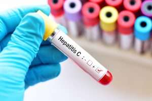 Apa Itu Hepatitis C dan Bahaya Apa yang Serius dari Ini?
